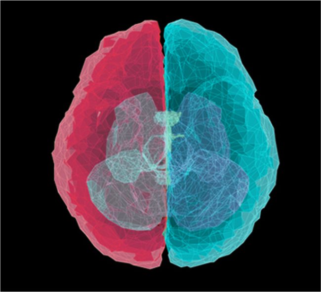 neglect-brain-img
