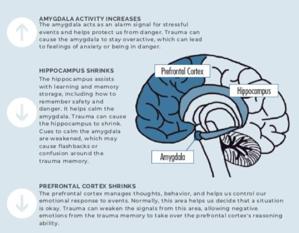trauma-focus-img